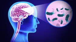 Woman dies of brain-eating amoeba after using tap water in nasal rinse device